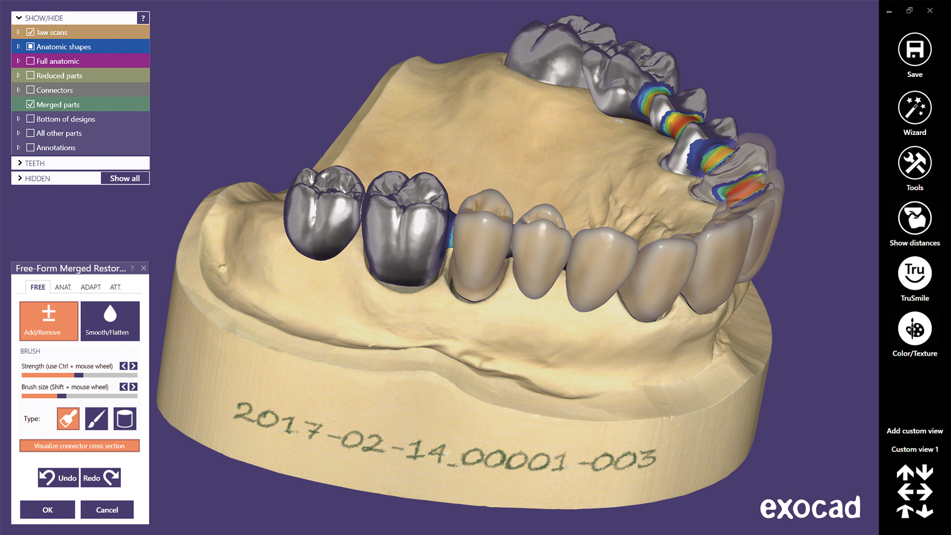 dentalcad_screenshot01